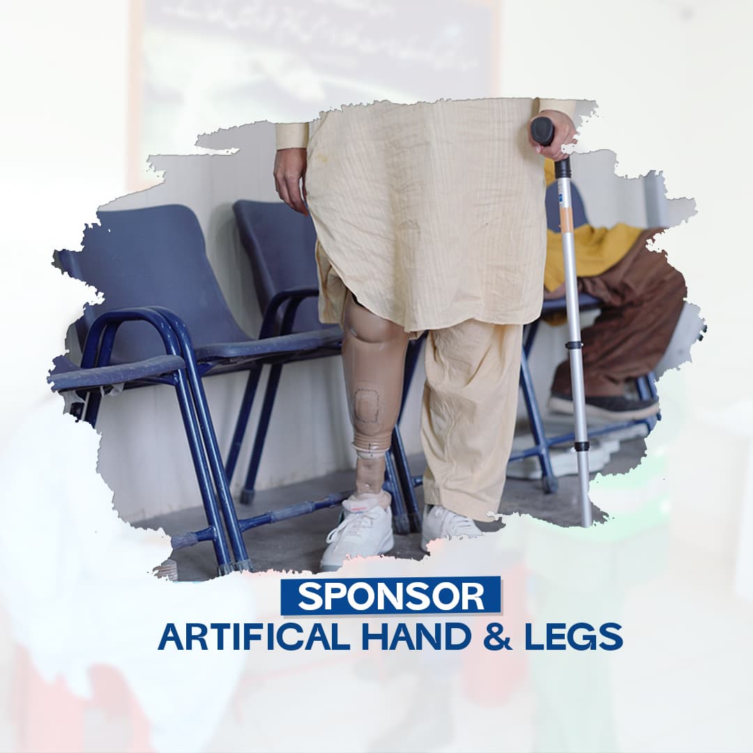 Artifical hands and legs